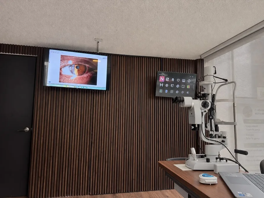 Preguntas frecuentes OCULARVIEW